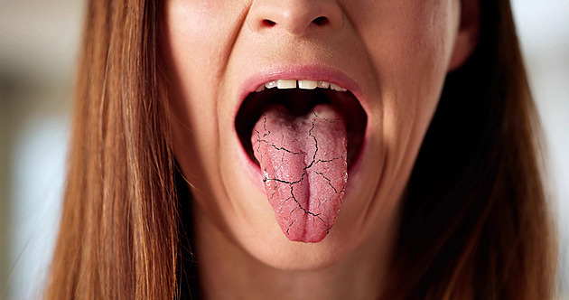 Co o vašem zdraví prozradí jazyk: barva, povlak i rýhy mohou být varováním