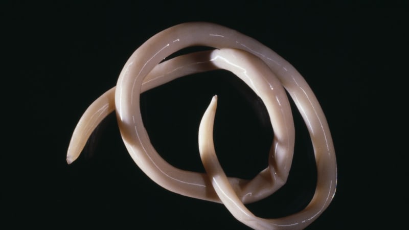 Nebezpečného parazita vykašlal pacient v Nitře. Na kliniku šel se srdečními problémy